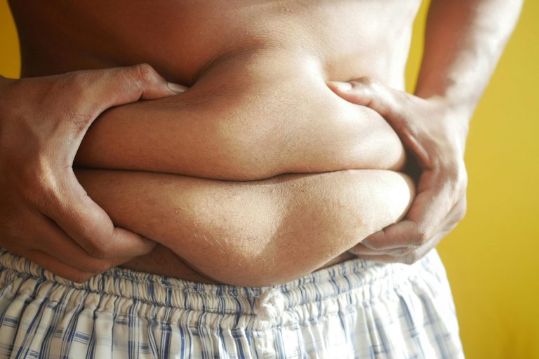 Obesity And Anxiety: The Link